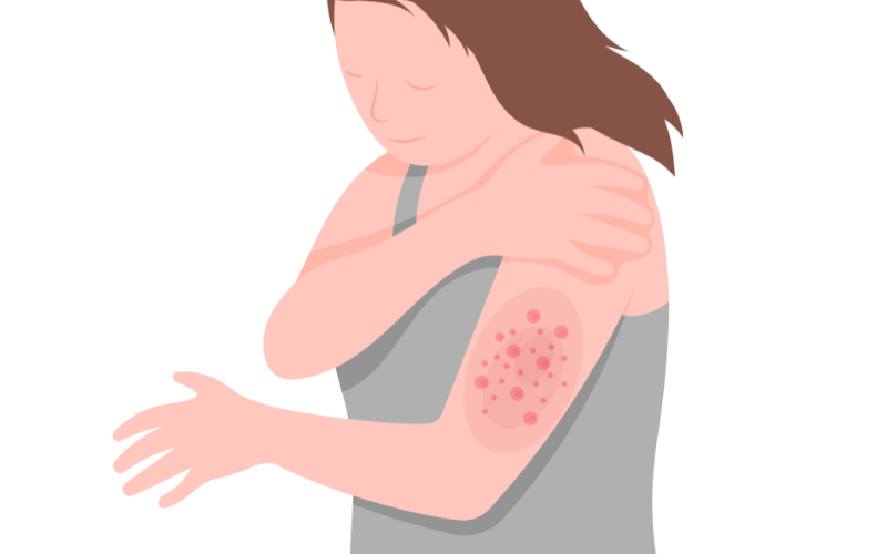Counselling Support for Autoimmune Diseases in Baksa